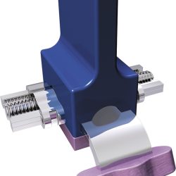 Parafusos Dentaurum 602-604 - Steiner