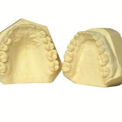 Elite Model Fast Gesso Light Cream 25Kg