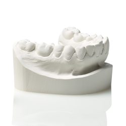 Elite Model Fast Gesso White Balde 25Kg