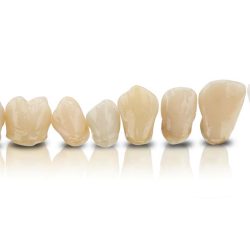VarseoSmile Crown Plus - Cart. 250g A2
